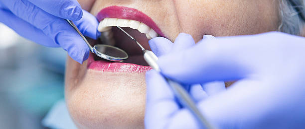 Best Chipped Tooth Repair Near Me  in Mount Airy, GA
